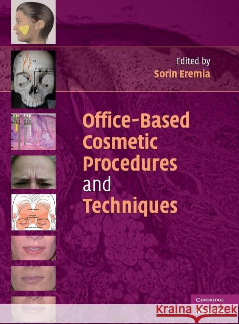 Office-Based Cosmetic Procedures and Techniques Sorin Eremia 9780521706520