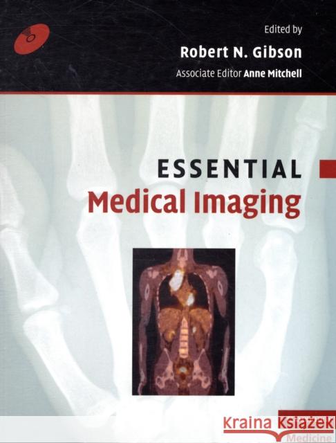 Essential Medical Imaging  9780521709118 CAMBRIDGE UNIVERSITY PRESS