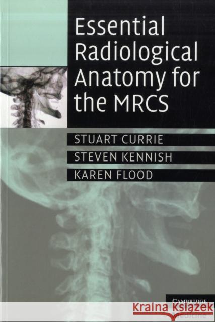 Essential Radiological Anatomy for the Mrcs Currie, Stuart 9780521728089 0