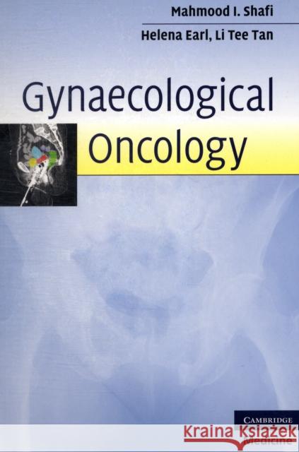 Gynaecological Oncology Mahmood I Shafi 9780521730242 0