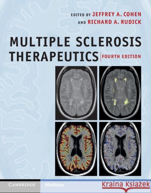 Multiple Sclerosis Therapeutics Jeffrey A Cohen 9780521766272