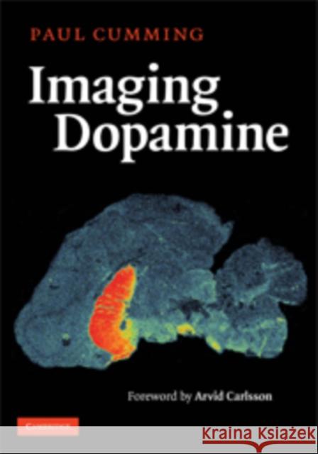 Imaging Dopamine Paul Cumming Albert Gjedde 9780521790024