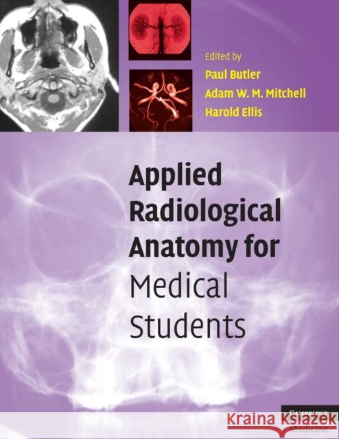 Applied Radiological Anatomy for Medical Students Paul Butler 9780521819398 0
