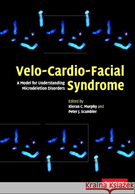 Velo-Cardio-Facial Syndrome : A Model for Understanding Microdeletion Disorders Kieran Murphy Peter Scambler 9780521821858 Cambridge University Press