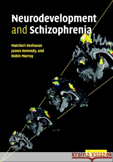 Neurodevelopment and Schizophrenia Matcheri S. Keshavan 9780521823319