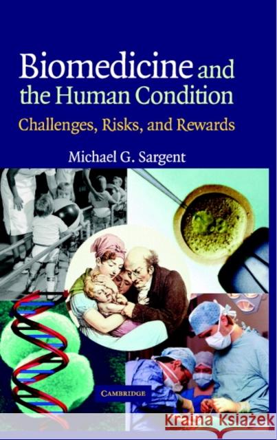 Biomedicine and the Human Condition: Challenges, Risks, and Rewards Sargent, Michael G. 9780521833660
