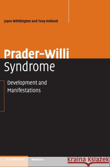 Prader-Willi Syndrome: Development and Manifestations Whittington, Joyce 9780521840293 Cambridge University Press