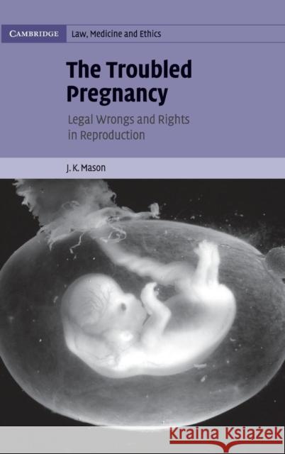 The Troubled Pregnancy : Legal Wrongs and Rights in Reproduction J. K. Mason 9780521850759 Cambridge University Press