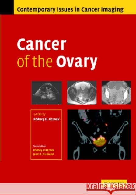 Cancer of the Ovary Rodney Reznek 9780521863230 Cambridge University Press