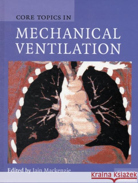 Core Topics in Mechanical Ventilation Iain Mackenzie 9780521867818 0