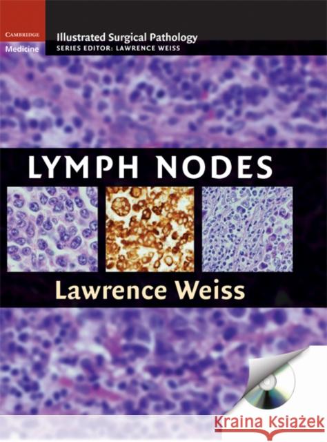 lymph nodes  Weiss, Lawrence M. 9780521871617