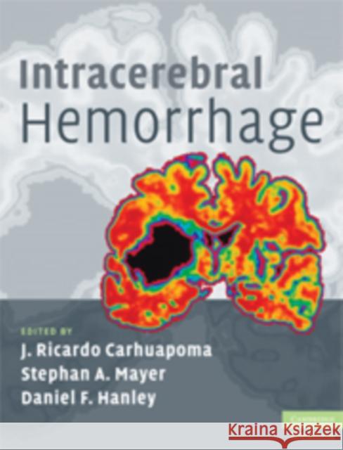 Intracerebral Hemorrhage J Ricardo Carhuapoma 9780521873314 0
