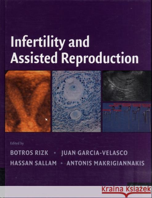 Infertitlity and Assisted Reproduction Rizk, Botros R. M. B. 9780521873796 0