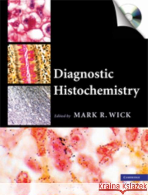 Diagnostic Histochemistry [With CDROM] Wick, Mark R. 9780521874106 CAMBRIDGE UNIVERSITY PRESS