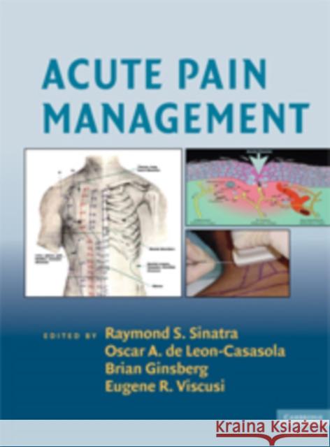 Acute Pain Management Raymond Sinatra 9780521874915