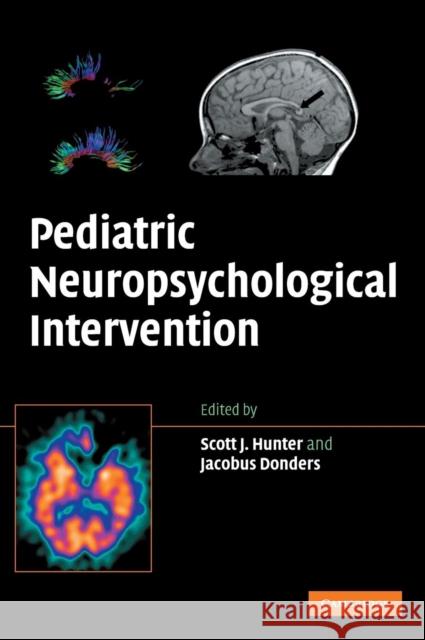 Pediatric Neuropsychological Intervention: A Critical Review of Science & Practice Hunter, Scott J. 9780521875509