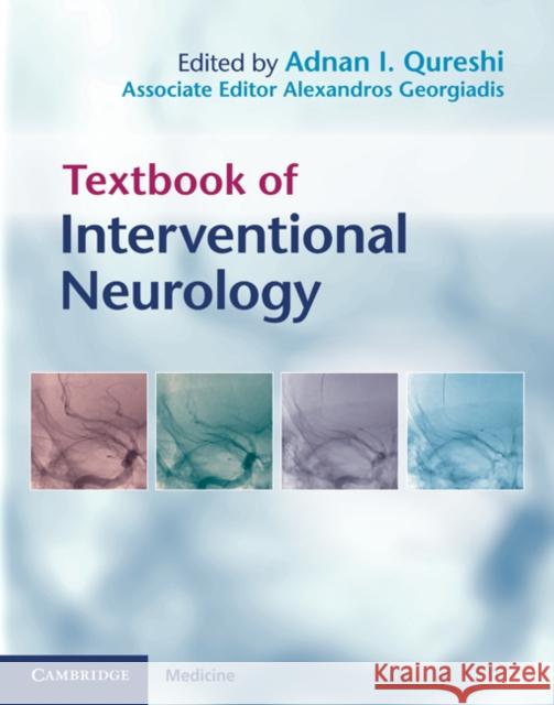 Textbook of Interventional Neurology Adnan I. Qureshi 9780521876391