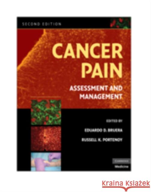 Cancer Pain: Assessment and Management Bruera, Eduardo D. 9780521879279