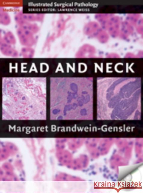 head and neck  Brandwein-Gensler, Margaret 9780521879996