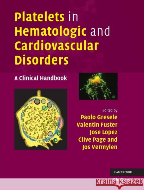 Platelets in Hematologic and Cardiovascular Disorders Gresele, Paolo 9780521881159 0