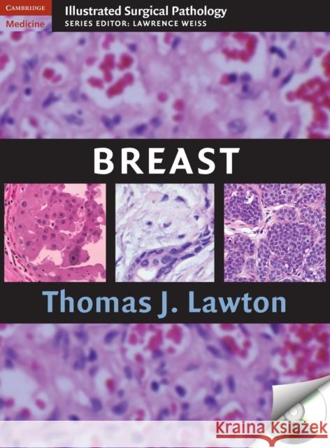 Breast [With CDROM] Lawton, Thomas J. 9780521881593 0