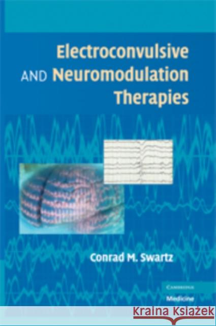 Electroconvulsive and Neuromodulation Therapies Conrad M Swartz 9780521883887
