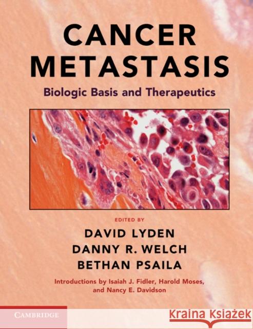 Cancer Metastasis: Biologic Basis and Therapeutics Lyden, David 9780521887212 0