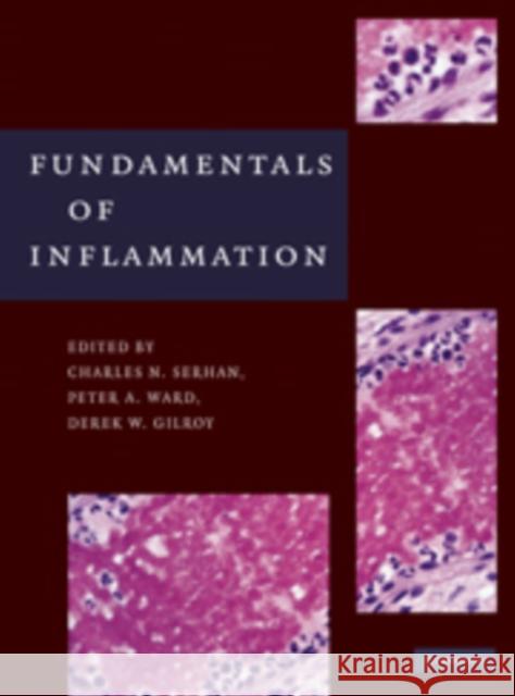 Fundamentals of Inflammation Charles N. Serhan Peter A. Ward Derek W. Gilroy 9780521887298 Cambridge University Press