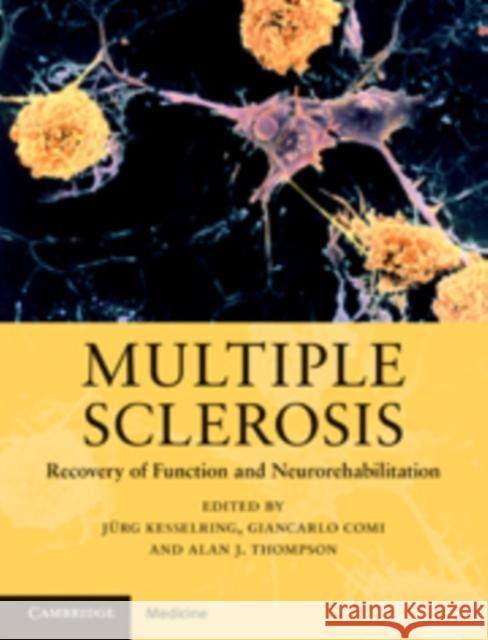 Multiple Sclerosis: Recovery of Function and Neurorehabilitation Kesselring, Jürg 9780521888325 0