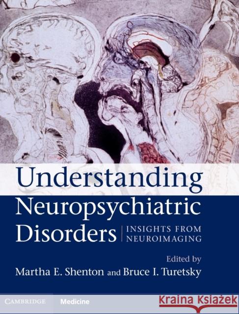 Understanding Neuropsychiatric Disorders: Insights from Neuroimaging Shenton, Martha E. 9780521899420 0