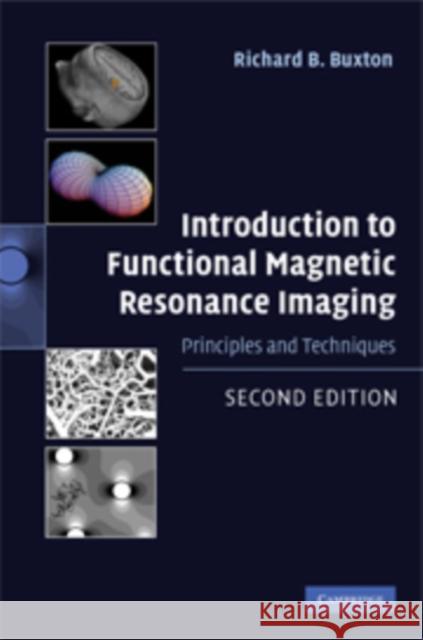 Introduction to Functional Magnetic Resonance Imaging: Principles and Techniques Buxton, Richard B. 9780521899956 0
