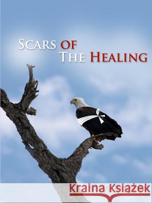 Scars of the Healing Steve Benson 9780557396900 Lulu.com