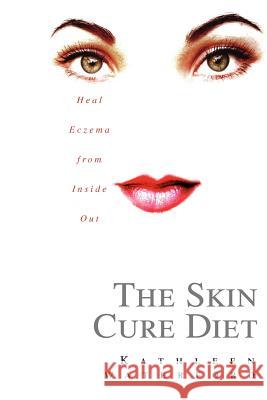 The Skin Cure Diet: Heal Eczema from Inside Out Waterford, Kathleen 9780595358830 iUniverse