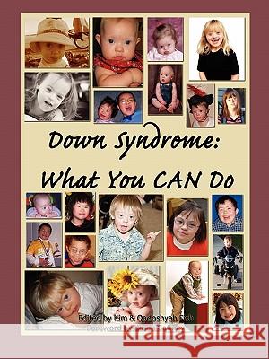 Down Syndrome: What You CAN Do Qadoshyah Fish 9780615259161 Qadoshyah Fish