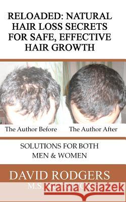 Reloaded: Natural Hair Loss Secrets for Safe, Effective Hair Growth David Rodger 9780615563831 Clear Stone Press