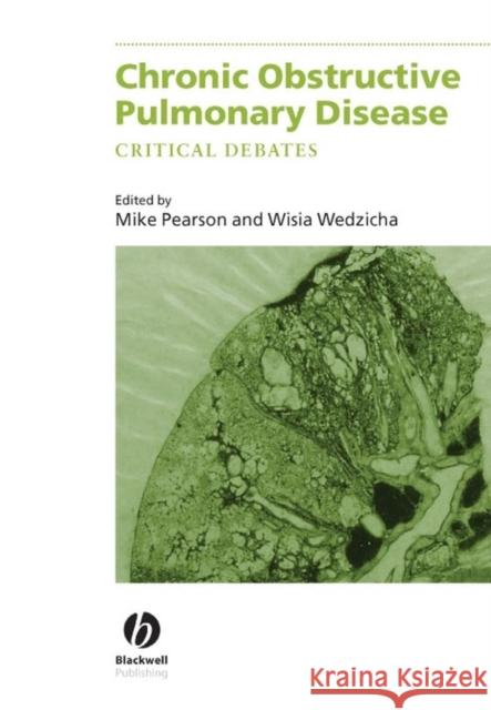 Chronic Obstructive Pulmonary Disease : Critical Debates Michael Pearson Jadwiga Anna Wedzicha Wisia Wedzicha 9780632059720 