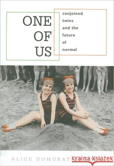 One of Us: Conjoined Twins and the Future of Normal Dreger, Alice Domurat 9780674018259 Harvard University Press