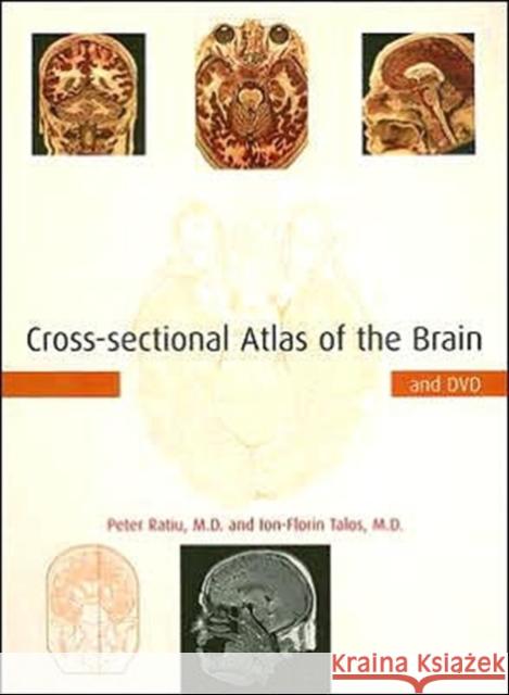 Cross-sectional Atlas of the Brain and DVD Peter Ratiu Ion-Florin Talos 9780674019232 Harvard University Press
