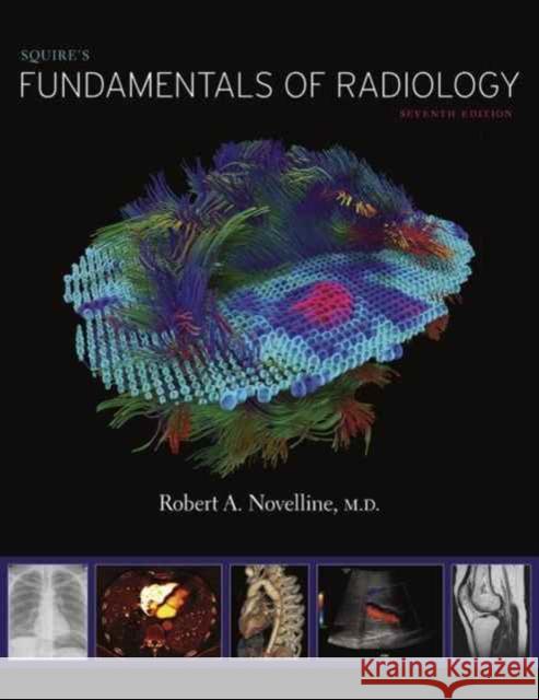 Squire's Fundamentals of Radiology: Seventh Edition Novelline, Robert A. 9780674057951 John Wiley & Sons