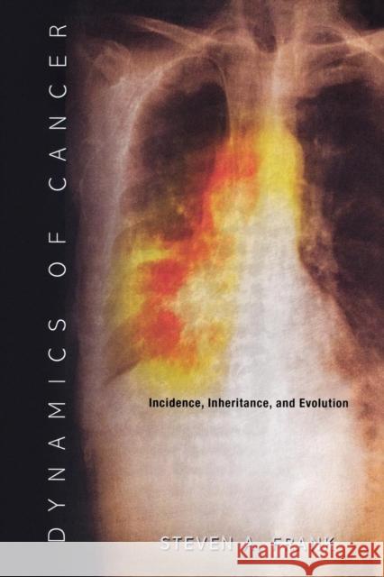 Dynamics of Cancer: Incidence, Inheritance, and Evolution Frank, Steven A. 9780691133669 Princeton University Press