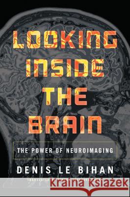 Looking Inside the Brain: The Power of Neuroimaging Denis L Teresa Lavender Fagan 9780691160610 Princeton University Press