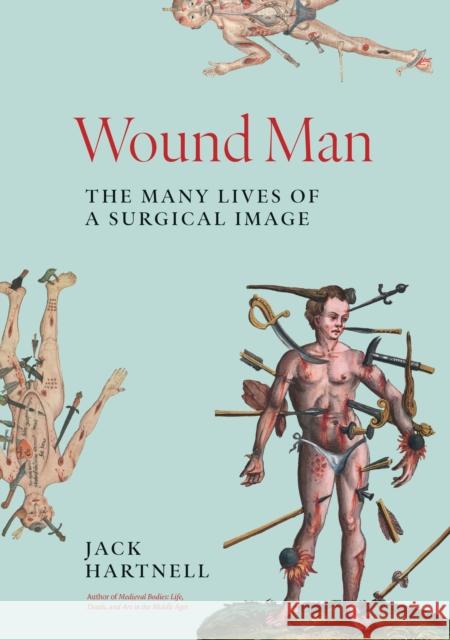 Wound Man: The Many Lives of a Surgical Image Jack Hartnell 9780691243481 Princeton University Press