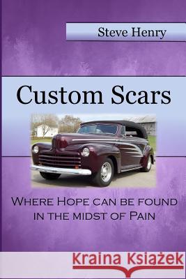Custom Scars: Where Hope Can Be Found in the Midst of Pain April Williams Steve Henry 9780692155707
