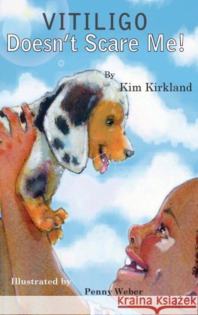 Vitiligo Doesn't Scare Me Kim Kirkland   9780692825525 Asg Productions