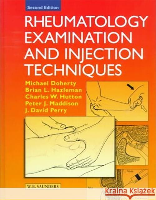 Rheumatology Examination and Injection Techniques Michael Doherty Brian L. Hazleman Charles W. Hutton 9780702023873 Saunders Book Company