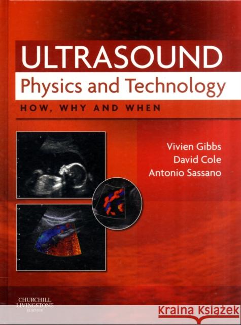 Ultrasound Physics and Technology: How, Why and When Gibbs, Vivien 9780702030413 ELSEVIER HEALTH SCIENCES