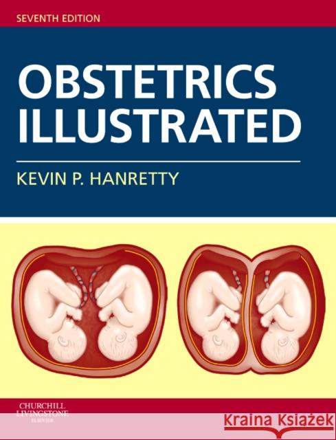 Obstetrics Illustrated Kevin P. Hanretty 9780702030666 ELSEVIER HEALTH SCIENCES