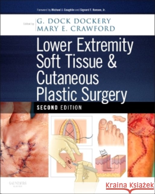 Lower Extremity Soft Tissue & Cutaneous Plastic Surgery G  Dock Dockery 9780702031366
