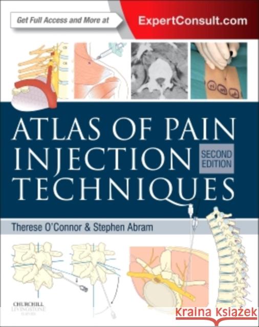 Atlas of Pain Injection Techniques O'Connor, Therese C. 9780702044717 Churchill Livingstone