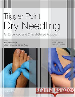 Trigger Point Dry Needling: An Evidence and Clinical-Based Approach Jan Dommerholt 9780702046018 CHURCHILL LIVINGSTONE